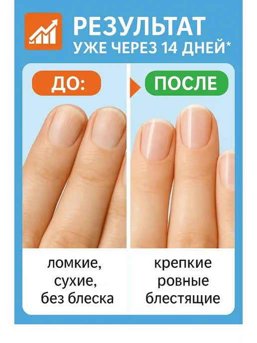 aikanya13 Гель-ремувер для удаления кутикулы 20 г, 20 г