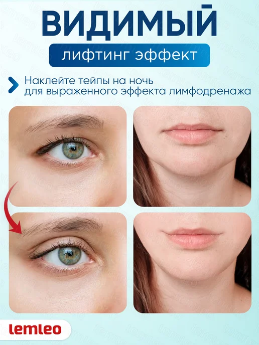 Тейпы для тела. Кинезио тейп, белый, фото 2