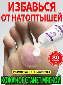 Крем для ног с мочевиной 30% от натоптышей для смягчения